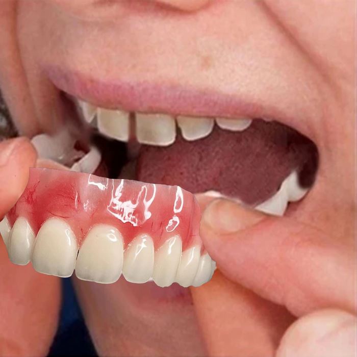 LEVE 2 PAGUE 1 - Dentadura de Silicone FIX | Ajustavel e Adaptativa